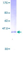 Human RAC1 Protein (Recombinant GST)