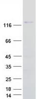 Human ITGA6/Integrin Alpha 6/CD49f Protein (Recombinant Myc-DDK (Flag))