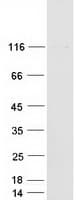 Human PPFIBP1 Protein (Recombinant Myc-DDK (Flag))