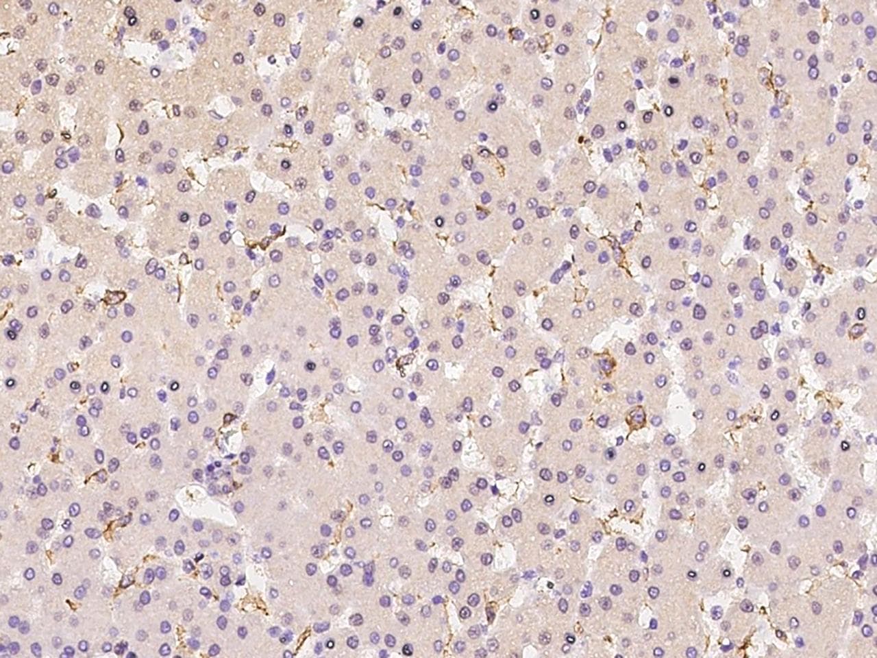 Polyclonal Rabbit anti-Human FCGR3A / CD16A Antibody (Preservative Free, IHC)