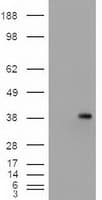 Monoclonal Mouse anti-Human EPCAM Antibody (clone OTI2C8, IHC, WB)