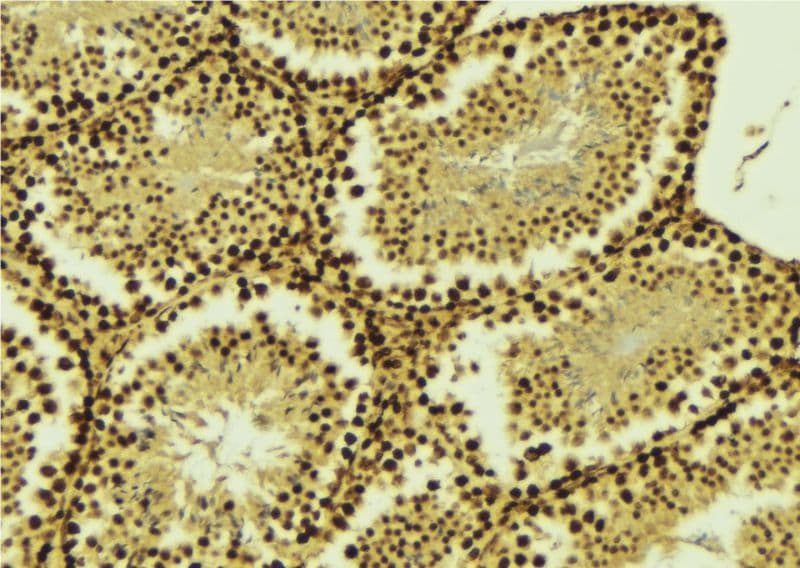 EZH2 Antibody