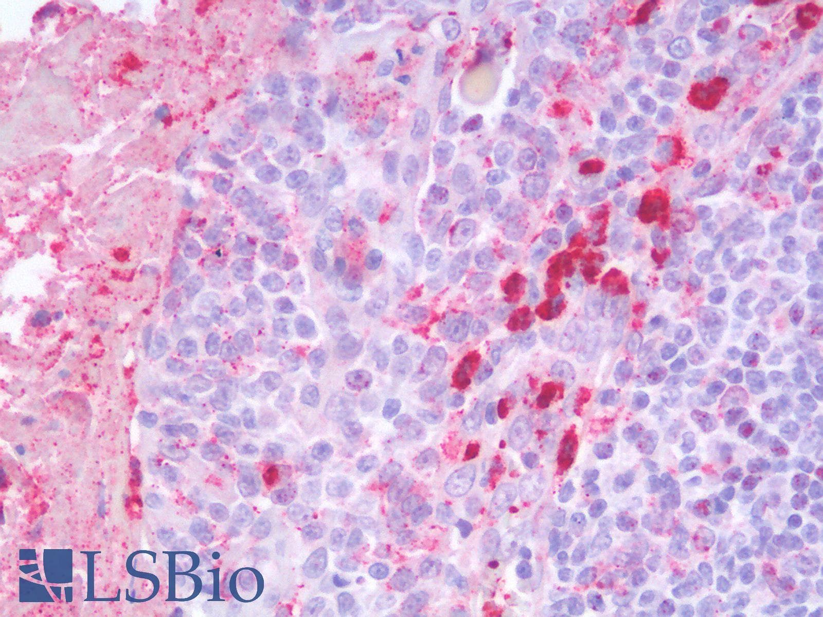 PathPlus™ Polyclonal Rabbit anti-Rat MMP9 / Gelatinase B Antibody (IHC)