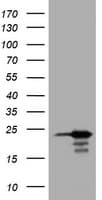 IHC-plus™ Monoclonal Mouse anti-Human VILIP / VSNL1 Antibody (clone 4G1, aa2-191, IHC, WB)