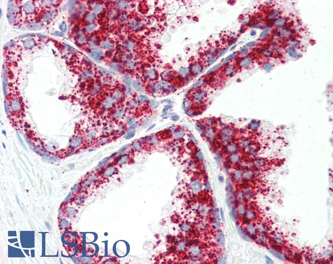 IHC-plus™ Polyclonal Rabbit anti-Human LIMPII / SCARB2 Antibody (IHC, IF, WB)