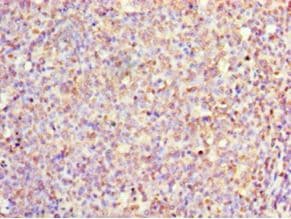 IL1F10 Antibody (aa1-152)