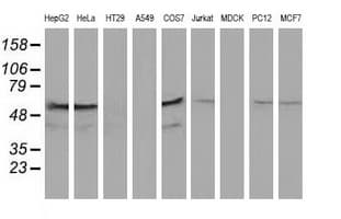 Monoclonal Mouse anti-Human KATNAL1 Antibody (clone OTI1A7, IHC, WB)