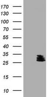 BCL10 / BCL-10 Antibody (clone OTI2G9)