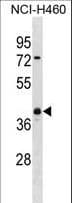 UCHL5 / UCH37 Antibody (aa136-164)