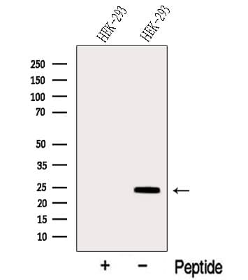 SIKE1 Antibody