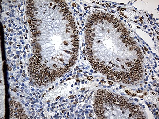SLU7 / 9G8 Antibody (aa1-300, clone OTI6B1)