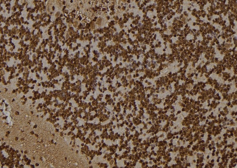 DDX5 Antibody