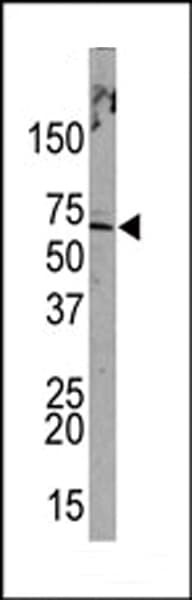 PML Antibody (aa470-499)