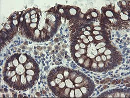 DPH2 Antibody (clone OTI3A12)