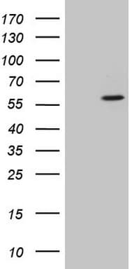 Monoclonal Mouse anti-Human CSNK1G1 / CKI-Gamma 1 Antibody (clone OTI2B5, aa163-422, WB)