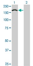 Treacle / TCOF1 Antibody (clone 8H3)