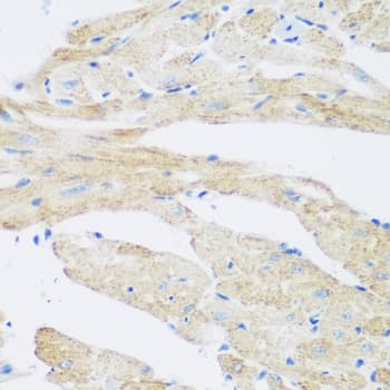 Polyclonal Rabbit anti-Human NAT8B Antibody (IHC, IF, WB)