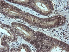 Monoclonal Mouse anti-Human MAP2K3 / MEK3 / MKK3 Antibody (clone OTI1H6, IHC, IF, WB)