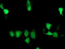 SOCS3 Antibody (clone OTI6C2)