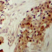 MAPK14 / p38 Antibody (phospho-Tyr182)