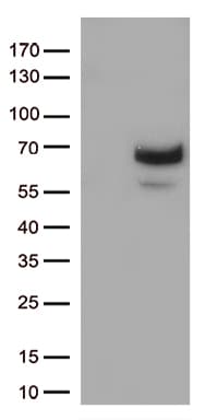 Monoclonal Mouse anti-Human MMP2 Antibody (clone OTI4B11, Carrier-free, aa228-507, WB)