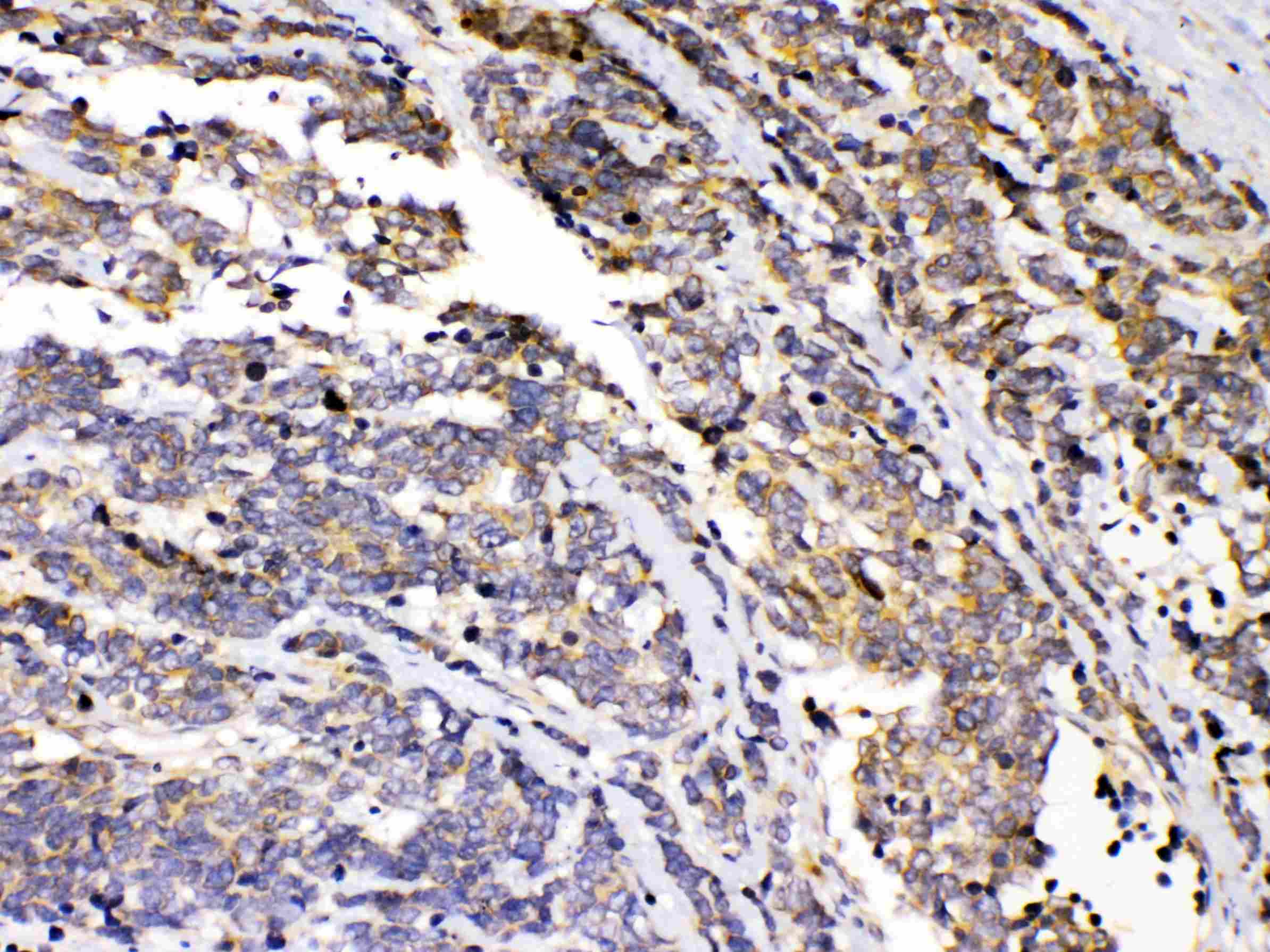 PRKAR1A Antibody