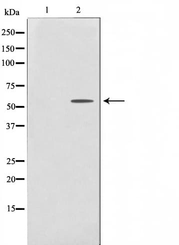 CYP2U1 Antibody