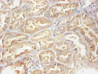 Monoclonal Mouse anti-Human RBP4 Antibody (WB)