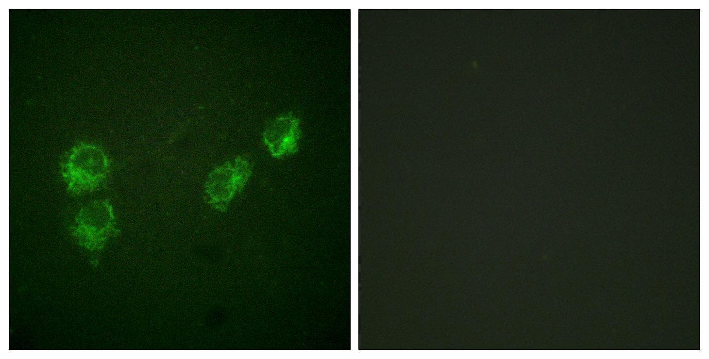 PLN / Phospholamban Antibody (phospho-Ser16+Thr17)