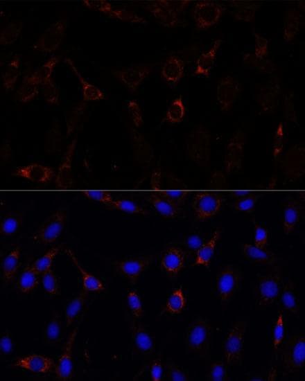 RNF112 / ZNF179 Antibody