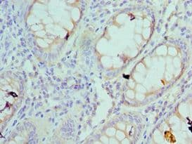 RPS4X + RPS4Y1 + RPS Antibody (aa66-263)