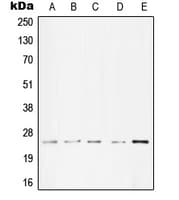 TNNI3 / Cardiac Troponin I Antibody (Internal)