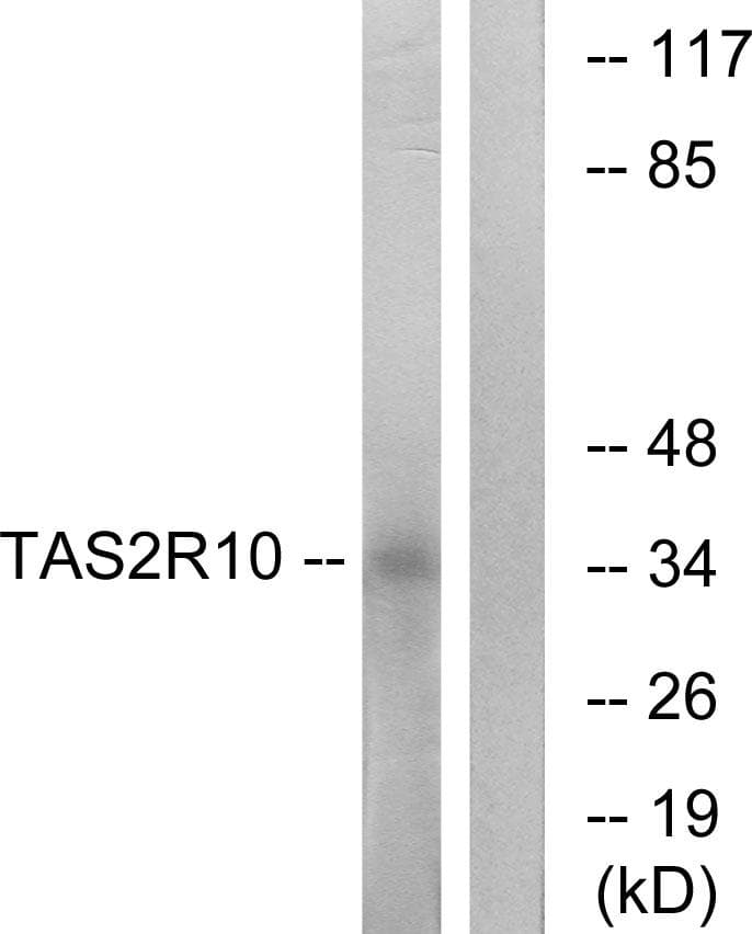 TAS2R10 / TRB2 Antibody