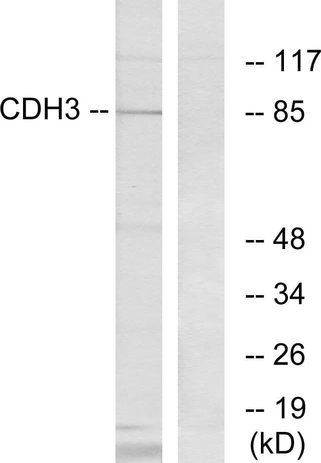 Polyclonal Rabbit anti-Human CDH3 / P-Cadherin Antibody (aa51-100, IHC, WB)