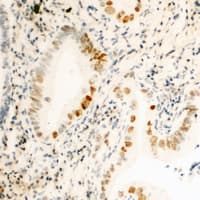 CCNH / Cyclin H Antibody (C-Terminus)