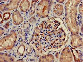 PKD3 / PRKD3 Antibody
