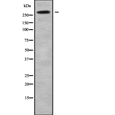 Polyclonal Rabbit anti-Human NAV2 Antibody (WB)