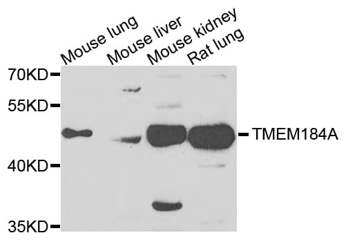 TMEM184A Antibody