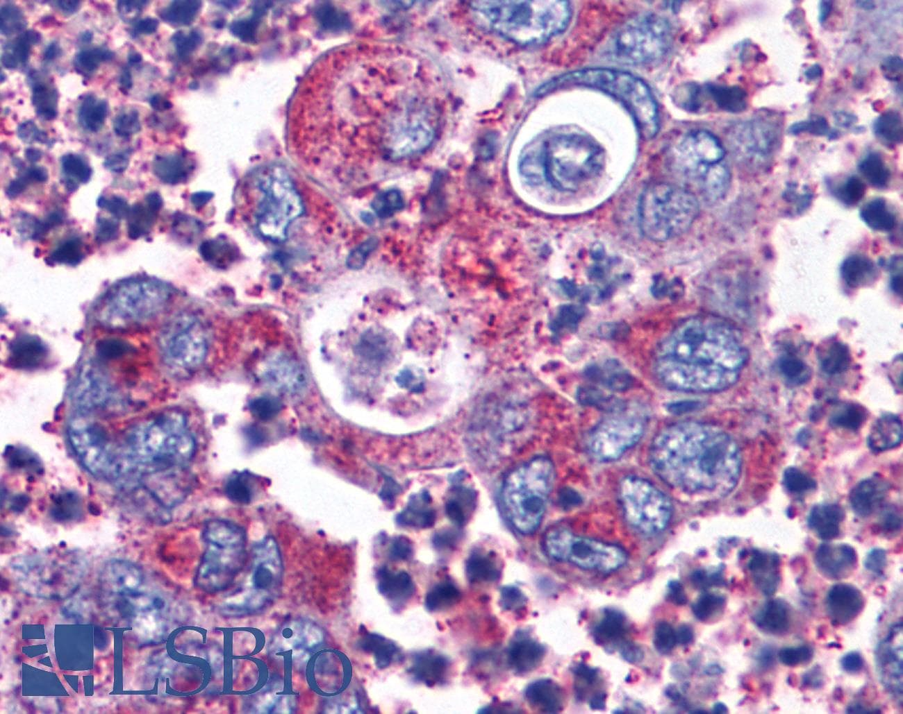PathPlus™ CCKBR / Cckb Antibody (Extracellular Domain)