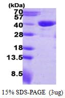 Human RTN4IP1 / NIMP Protein (Recombinant His)