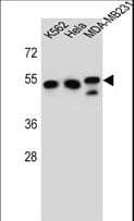 Polyclonal Rabbit anti-Human TUBB6 / Tubulin Beta 6 Antibody (aa139-166, WB)
