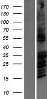 Human GRIN2B / NMDAR2B / NR2B Protein (Over-Expression Lysate Myc-DDK (Flag))