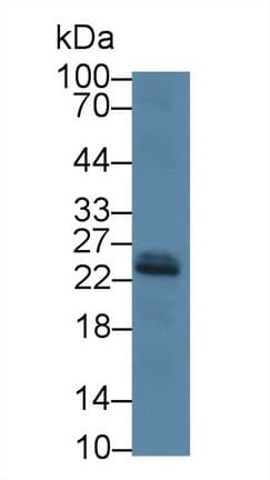 IGF1 Antibody (aa49-118, FITC)