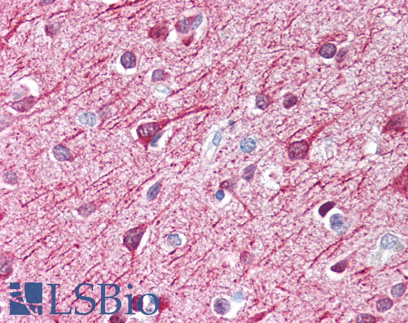 PathPlus™ MAP2 Antibody (C-Terminus)