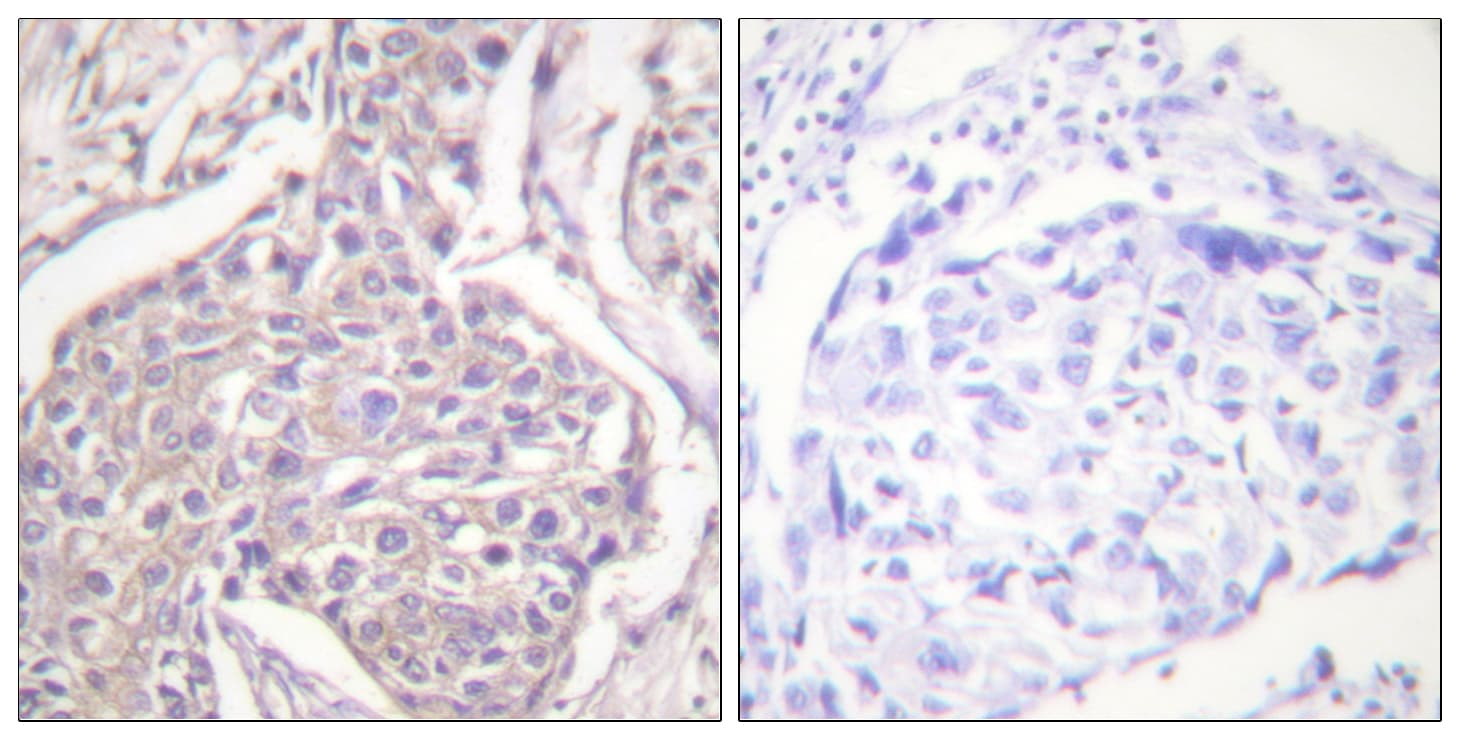 HSPB6 / HSP20 Antibody (phospho-Ser16)