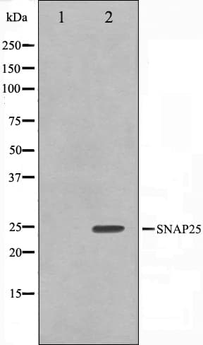 Polyclonal Rabbit anti-Human SNAP25 Antibody (IHC, IF, WB)
