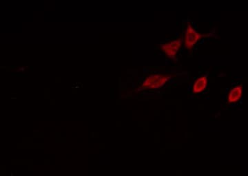 AMPD2 Antibody