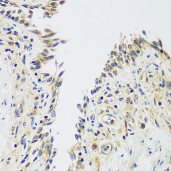 HUPF2 / UPF2 Antibody