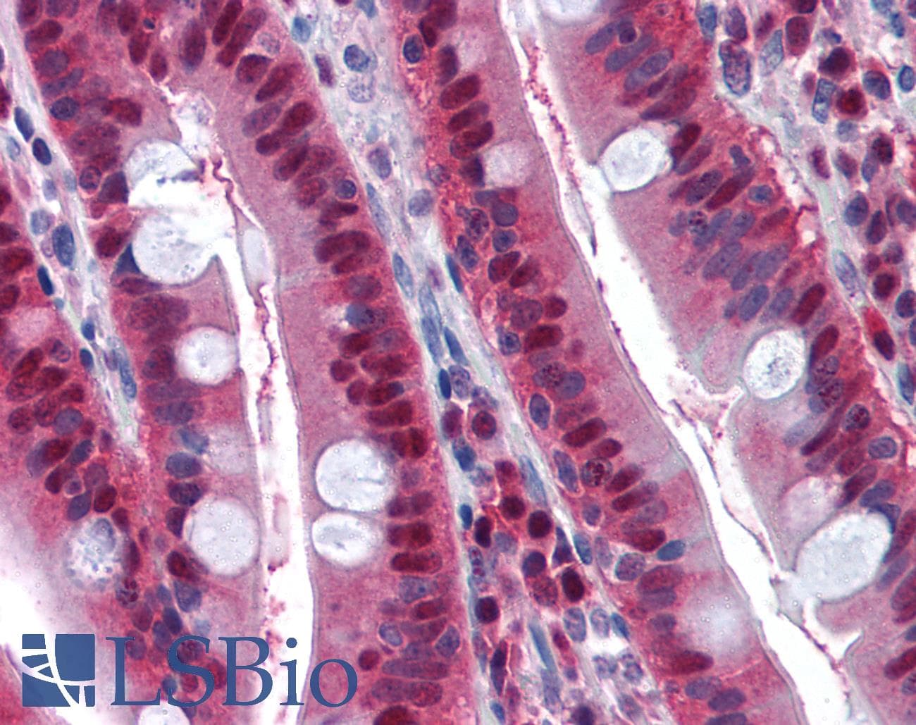 IHC-plus™ Polyclonal Rabbit anti-Human LTA4H / LTA4 Antibody (IHC, WB)
