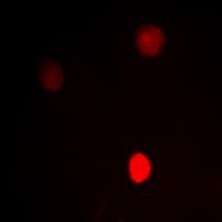 CTBP1 / CTBP Antibody (C-Terminus)